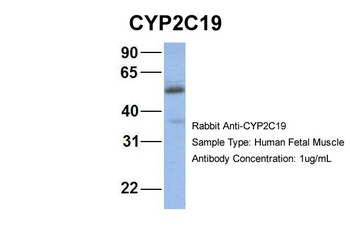 CYP2C19 Rabbit Polyclonal Antibody