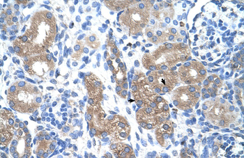 PTGS1 Rabbit Polyclonal Antibody