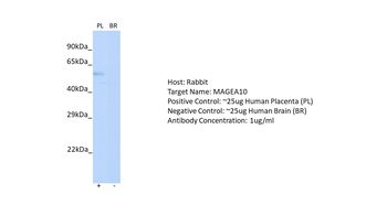 MAGEA10 Rabbit Polyclonal Antibody