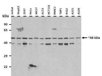 FECH Rabbit Polyclonal Antibody