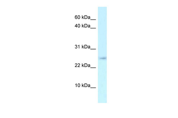 Arpp21 Rabbit Polyclonal Antibody
