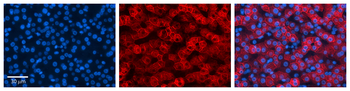 KRT8 Rabbit Polyclonal Antibody