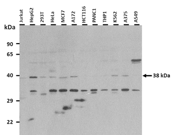 PSG5 Rabbit Polyclonal Antibody