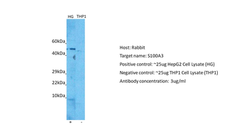 S100A3 Rabbit Polyclonal Antibody