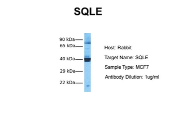 SQLE Rabbit Polyclonal Antibody