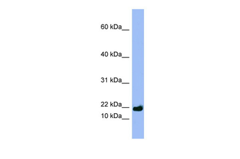 SPRR3 Rabbit Polyclonal Antibody
