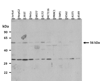 SLC1A5 Rabbit Polyclonal Antibody