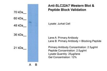 SLC22A7 Rabbit Polyclonal Antibody