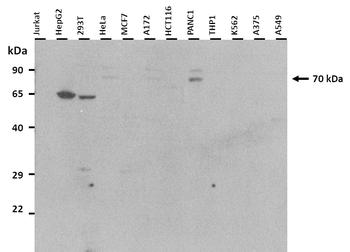 SLC20A2 Rabbit Polyclonal Antibody