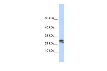 GNLY Rabbit Polyclonal Antibody