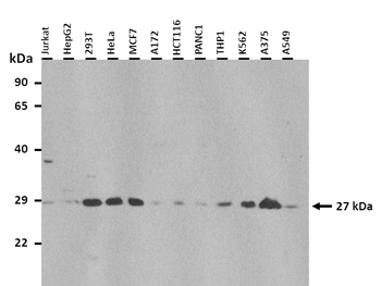 PLUNC Rabbit Polyclonal Antibody