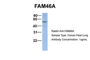 TENT5A Rabbit Polyclonal Antibody