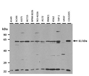 SLC38A4 Rabbit Polyclonal Antibody