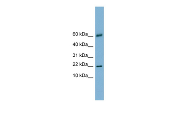 LGALS14 Rabbit Polyclonal Antibody