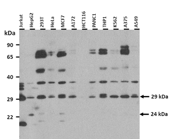 CHAC1 Rabbit Polyclonal Antibody