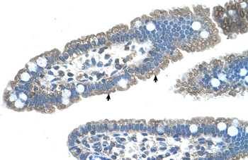 EDG8 Rabbit Polyclonal Antibody