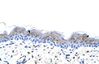 IRX3 Rabbit Polyclonal Antibody