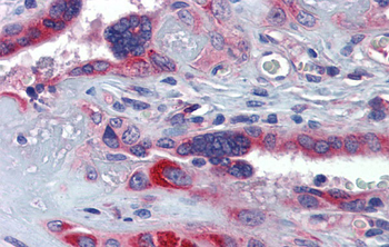 GTPBP10 Rabbit Polyclonal Antibody