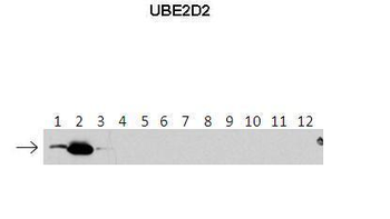 UBE2D2 Rabbit Polyclonal Antibody