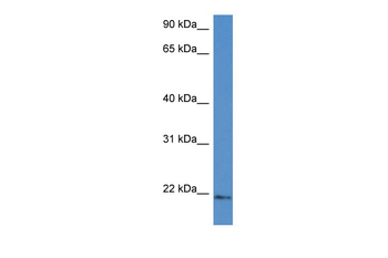 Ube2g1 Rabbit Polyclonal Antibody