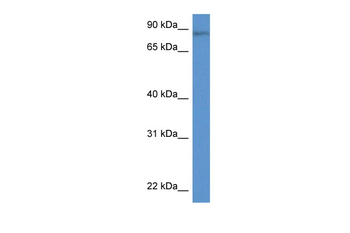 Trim36 Rabbit Polyclonal Antibody