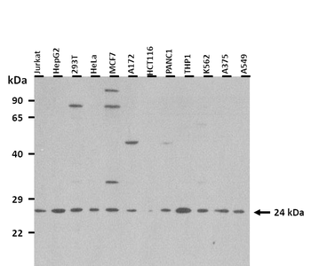 RNF186 Rabbit Polyclonal Antibody