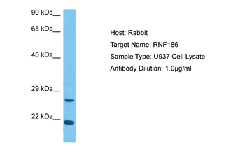 RNF186 Rabbit Polyclonal Antibody