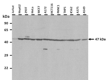 RNF128 Rabbit Polyclonal Antibody
