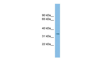 PCGF6 Rabbit Polyclonal Antibody