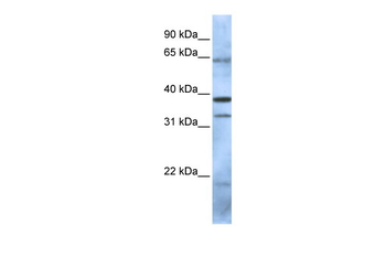 PCGF5 Rabbit Polyclonal Antibody