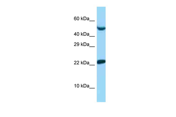 UBE2E1 Rabbit Polyclonal Antibody