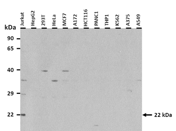 PEMT Rabbit Polyclonal Antibody