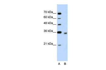 DECR2 Rabbit Polyclonal Antibody