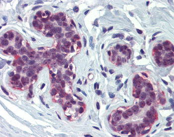 CREBBP Rabbit Polyclonal Antibody