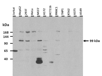 MTTP Rabbit Polyclonal Antibody