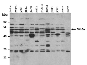 SNTB1 Rabbit Polyclonal Antibody