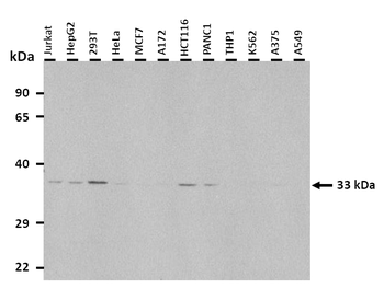 SLC25A20 Rabbit Polyclonal Antibody