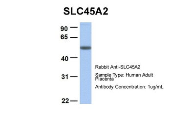 SLC45A2 Rabbit Polyclonal Antibody