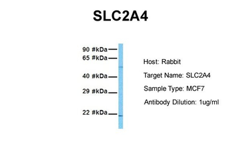 SLC2A4 Rabbit Polyclonal Antibody