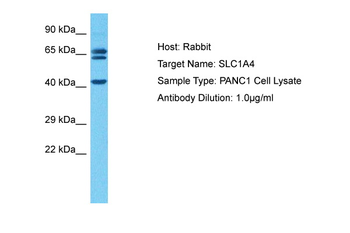SLC1A4 Rabbit Polyclonal Antibody