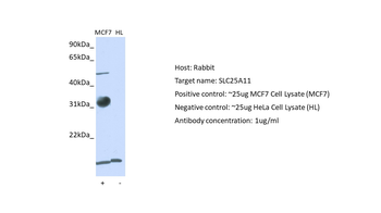 SLC25A11 Rabbit Polyclonal Antibody