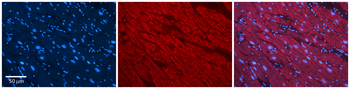 SLC25A12 Rabbit Polyclonal Antibody