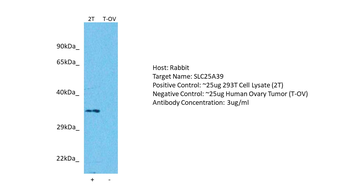 SLC25A39 Rabbit Polyclonal Antibody