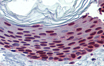 SLC35A5 Rabbit Polyclonal Antibody