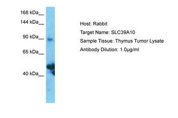 SLC39A10 Rabbit Polyclonal Antibody