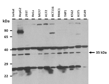 SLC25A42 Rabbit Polyclonal Antibody