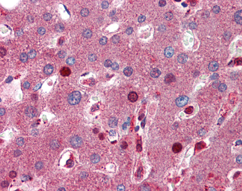 C8B Rabbit Polyclonal Antibody