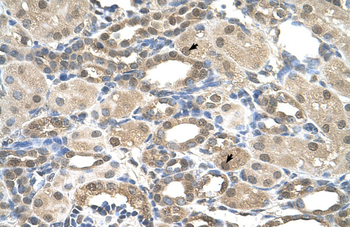 PSEN2 Rabbit Polyclonal Antibody