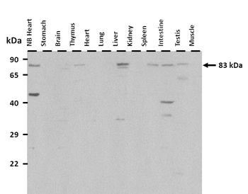 HGF Rabbit Polyclonal Antibody
