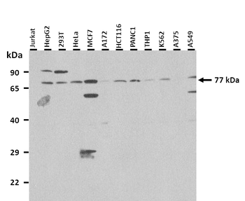 POR Rabbit Polyclonal Antibody